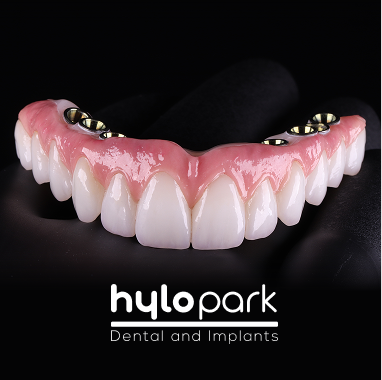 Hybrid Implant Bridge